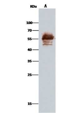 Invitrogen Calreticulin Polyclonal Antibody 100 &mu;L; Unconjugated:Antibodies,