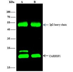Invitrogen CRHSP-24 Polyclonal Antibody 100 μL; Unconjugated:Antibodies,
