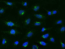 MCP-1 Polyclonal Antibody, Invitrogen 100 &mu;L; Unconjugated:Antibodies,