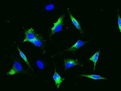 Invitrogen CD22 Polyclonal Antibody 100 &mu;L; Unconjugated:Antibodies,