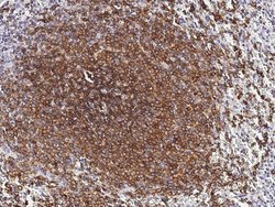 Invitrogen CD22 Polyclonal Antibody 100 &mu;L; Unconjugated:Antibodies,