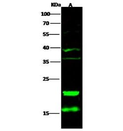 Invitrogen CD3z Polyclonal Antibody 100 μL; Unconjugated:Antibodies,