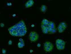 Invitrogen CD47 Polyclonal Antibody 100 &mu;L; Unconjugated:Antibodies,