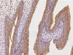 Invitrogen CD47 Polyclonal Antibody 100 &mu;L; Unconjugated:Antibodies,