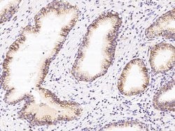 Invitrogen CD47 Polyclonal Antibody 100 &mu;L; Unconjugated:Antibodies,