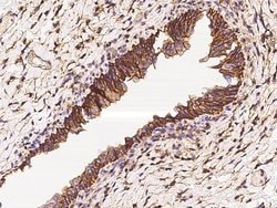 Invitrogen CD47 Polyclonal Antibody 100 &mu;L; Unconjugated:Antibodies,