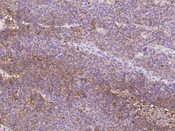 Invitrogen CD47 Polyclonal Antibody 100 &mu;L; Unconjugated:Antibodies,