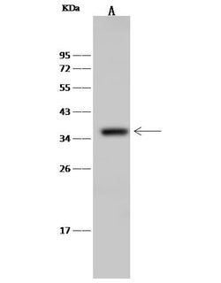 Invitrogen CD68 Polyclonal Antibody 100 &mu;L; Unconjugated:Antibodies,