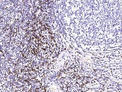 CD8 beta Polyclonal Antibody:Antibodies, Polyclonal