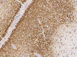 Invitrogen CDC37 Polyclonal Antibody 100 &mu;L; Unconjugated:Antibodies,