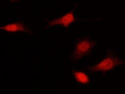 Invitrogen p16INK4a Polyclonal Antibody 100 &mu;L | Buy Online | Invitrogen&trade; | Fisher Scientific