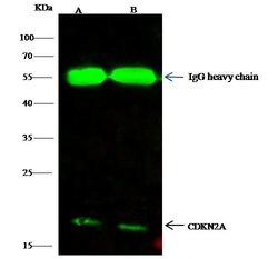 Invitrogen p16INK4a Polyclonal Antibody 100 &mu;L | Buy Online | Invitrogen&trade; | Fisher Scientific