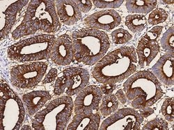 Invitrogen CEACAM1 Polyclonal Antibody 100 &mu;L; Unconjugated:Antibodies,