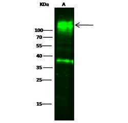 Invitrogen CEACAM1 Polyclonal Antibody 100 &mu;L; Unconjugated:Antibodies,
