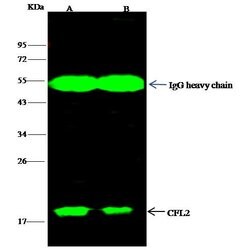 Invitrogen Cofilin 2 Polyclonal Antibody 100 &mu;L; Unconjugated:Antikörper