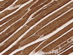 Invitrogen Creatine Kinase MB Polyclonal Antibody 100 &mu;L; Unconjugated:Antibodies,