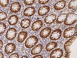 Invitrogen Claudin 4 Polyclonal Antibody 100 &mu;L | Buy Online | Invitrogen&trade; | Fisher Scientific