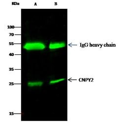 Invitrogen CNPY2 Polyclonal Antibody 100 &mu;L; Unconjugated:Antibodies,