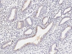 Invitrogen Carboxypeptidase M Polyclonal Antibody 100 &mu;L; Unconjugated:Antibodies,