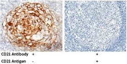 Invitrogen CD21 Polyclonal Antibody 100 &mu;L; Unconjugated:Antibodies,