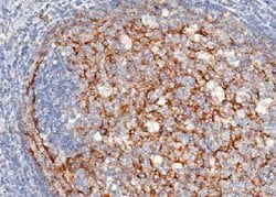 Invitrogen CD21 Polyclonal Antibody 100 &mu;L; Unconjugated:Antibodies,