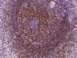 Invitrogen CD21 Polyclonal Antibody 100 &mu;L; Unconjugated:Antibodies,