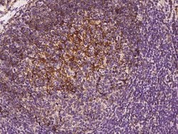 Invitrogen CD21 Polyclonal Antibody 100 &mu;L; Unconjugated:Antibodies,