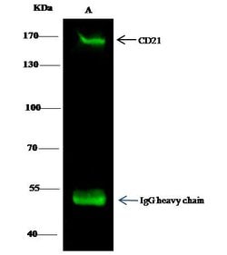 Invitrogen CD21 Polyclonal Antibody 100 &mu;L; Unconjugated:Antibodies,