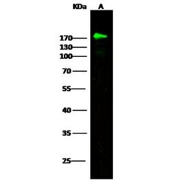 Invitrogen CD21 Polyclonal Antibody 100 &mu;L; Unconjugated:Antibodies,