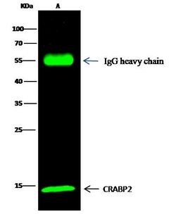 Invitrogen CRABP2 Polyclonal Antibody 100 &mu;L; Unconjugated:Antibodies,
