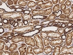 Invitrogen Citrate Synthase Polyclonal Antibody 100 &mu;L; Unconjugated:Antibodies,