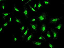 Invitrogen CK2 alpha-2 Polyclonal Antibody 100 &mu;L; Unconjugated:Antibodies,