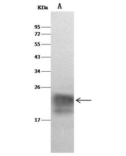 Invitrogen Cystatin F Polyclonal Antibody 100 &mu;L; Unconjugated:Antibodies,