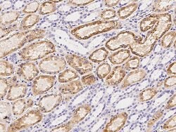 Invitrogen Cathepsin B Polyclonal Antibody 100 &mu;L; Unconjugated:Antibodies,