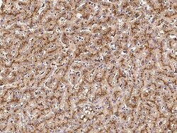 Invitrogen Cathepsin B Polyclonal Antibody 100 &mu;L; Unconjugated:Antibodies,