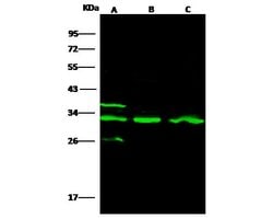 Invitrogen Cathepsin B Polyclonal Antibody 100 &mu;L; Unconjugated:Antibodies,