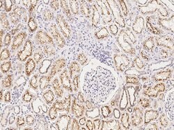 Invitrogen CUX1 Polyclonal Antibody 100 &mu;L | Buy Online | Invitrogen&trade; | Fisher Scientific