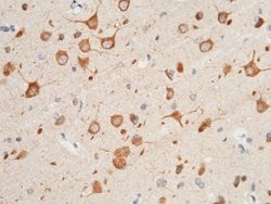 Invitrogen CX3CL1 Polyclonal Antibody 100 &mu;L; Unconjugated:Antibodies,