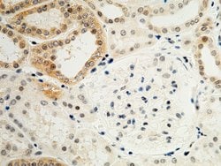 Invitrogen CX3CL1 Polyclonal Antibody 100 &mu;L; Unconjugated:Antibodies,