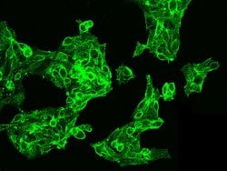 Invitrogen CAR Polyclonal Antibody 100 &mu;L | Buy Online | Invitrogen&trade; | Fisher Scientific