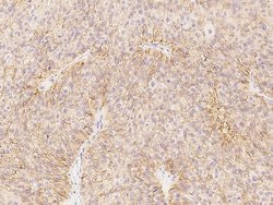 Invitrogen CAR Polyclonal Antibody 100 &mu;L | Buy Online | Invitrogen&trade; | Fisher Scientific