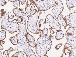 Aromatase Polyclonal Antibody, Invitrogen 100 &mu;L; Unconjugated:Antibodies,