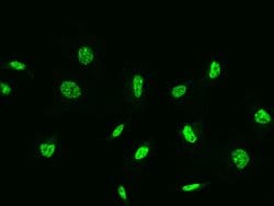ZIPK Polyclonal Antibody:Antibodies, Polyclonal