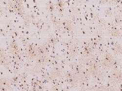 ZIPK Polyclonal Antibody:Antibodies, Polyclonal