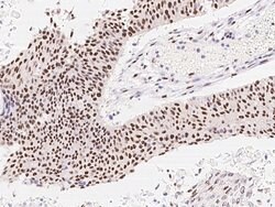 ZIPK Polyclonal Antibody:Antibodies, Polyclonal