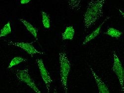 Invitrogen DAZ1 Polyclonal Antibody 100 &mu;L | Buy Online | Invitrogen&trade; | Fisher Scientific