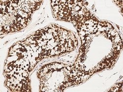 Invitrogen DAZ1 Polyclonal Antibody 100 &mu;L | Buy Online | Invitrogen&trade; | Fisher Scientific