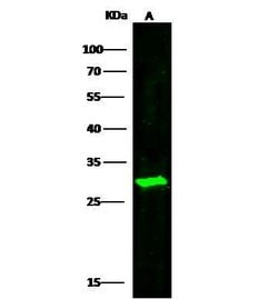 Invitrogen DCUN1D1 Polyclonal Antibody 100 &mu;L; Unconjugated:Antibodies,