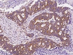 Invitrogen DKK3 Polyclonal Antibody 100 &mu;L; Unconjugated:Antibodies,