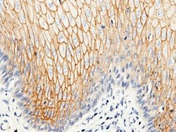 Invitrogen Desmocollin 2 Polyclonal Antibody 100 &mu;L; Unconjugated:Antibodies,